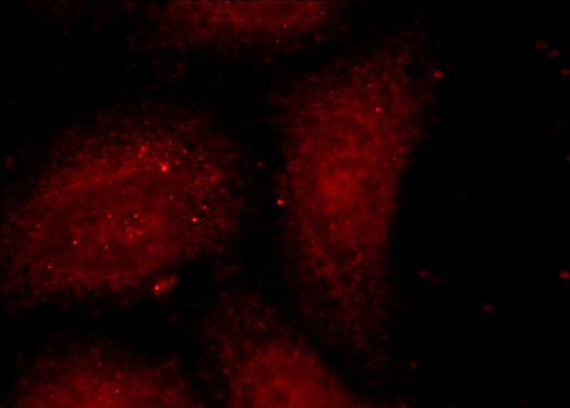 Immunofluorescent analysis of MCF-7 cells using Catalog No:113999(POLD3 Antibody) at dilution of 1:25 and Rhodamine-Goat anti-Rabbit IgG