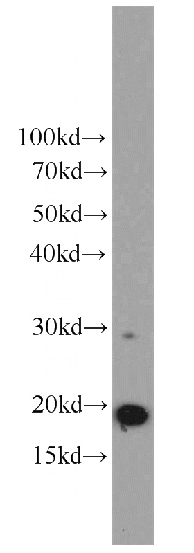 A2780 cells were subjected to SDS PAGE followed by western blot with Catalog No:111597(ICT1 antibody) at dilution of 1:600