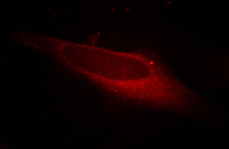 Immunofluorescent analysis of Hela cells, using LPCAT1 antibody Catalog No: at 1:50 dilution and Rhodamine-labeled goat anti-mouse IgG (red).