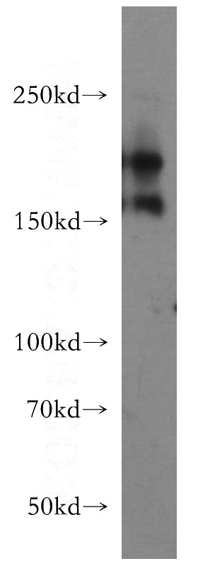 human brain tissue were subjected to SDS PAGE followed by western blot with Catalog No:115944(TNR-Specific antibody) at dilution of 1:300