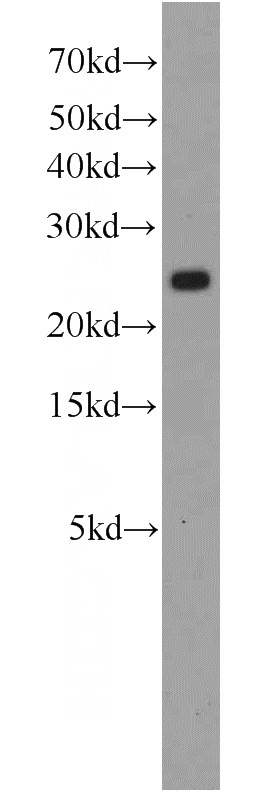 HeLa cells were subjected to SDS PAGE followed by western blot with Catalog No:114910(RPS5 antibody) at dilution of 1:600