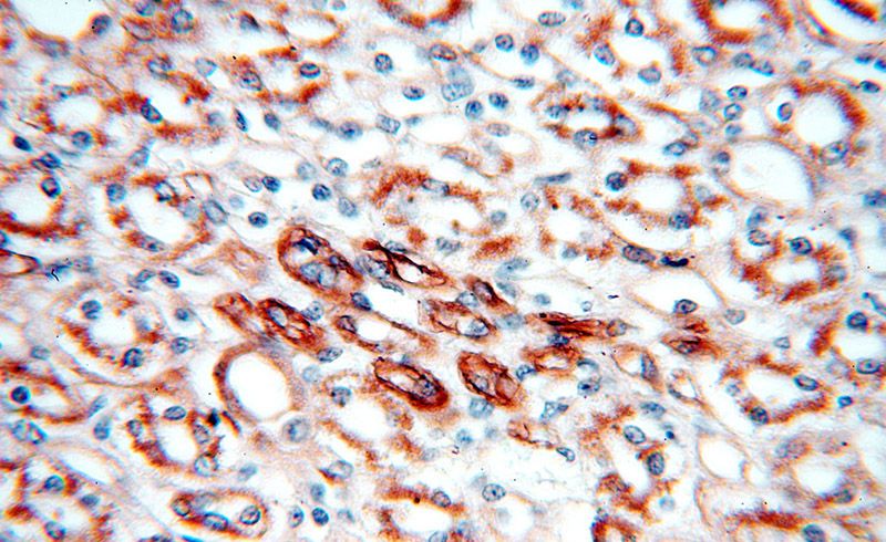 Immunohistochemical of paraffin-embedded human kidney using Catalog No:112097(KLHL20 antibody) at dilution of 1:50 (under 40x lens)
