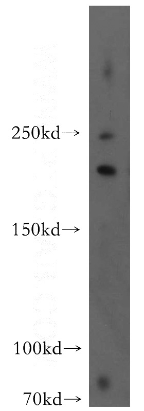 HeLa cells were subjected to SDS PAGE followed by western blot with Catalog No:110523(FANCM antibody) at dilution of 1:300