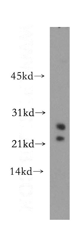mouse testis tissue were subjected to SDS PAGE followed by western blot with Catalog No:115880(TBPL1 antibody) at dilution of 1:400