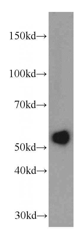 HepG2 cells were subjected to SDS PAGE followed by western blot with Catalog No:116397(TRMT2B antibody) at dilution of 1:300