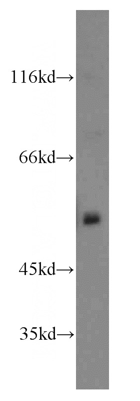 mouse brain tissue were subjected to SDS PAGE followed by western blot with Catalog No:116843(WASL antibody) at dilution of 1:500
