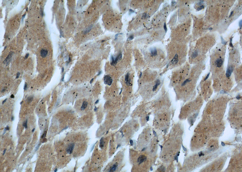Immunohistochemical of paraffin-embedded human heart using Catalog No:107191(LIMA1 antibody) at dilution of 1:50 (under 40x lens)