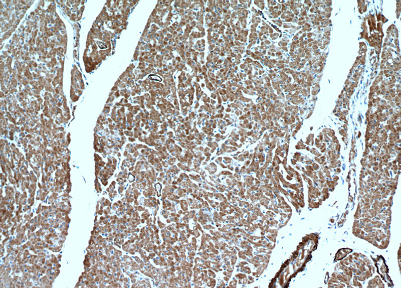 Immunohistochemical of paraffin-embedded human heart using Catalog No:115013(SCO2 antibody) at dilution of 1:50 (under 10x lens)