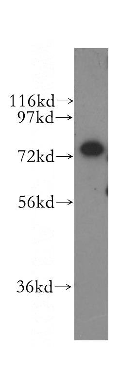 HEK-293 cells were subjected to SDS PAGE followed by western blot with Catalog No:109526(CPSF3 antibody) at dilution of 1:300