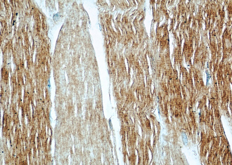 Immunohistochemical of paraffin-embedded human skeletal muscle using Catalog No:114361(PYGM-Specific antibody) at dilution of 1:50 (under 40x lens)