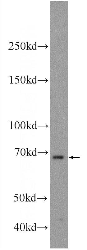 HepG2 cells were subjected to SDS PAGE followed by western blot with Catalog No:115048(SALL4 Antibody) at dilution of 1:1000