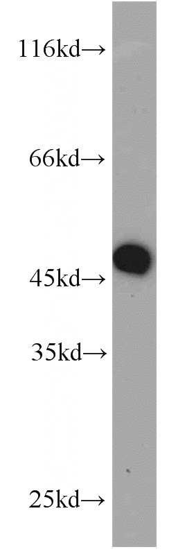 HL-60 cells were subjected to SDS PAGE followed by western blot with Catalog No:112643(MAP2K2 antibody) at dilution of 1:1000