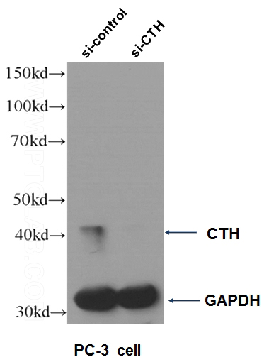 WB result of CTH antibody (Catalog No:107287, 1:500) with si-control and si-CTH transfected PC-3 cells.