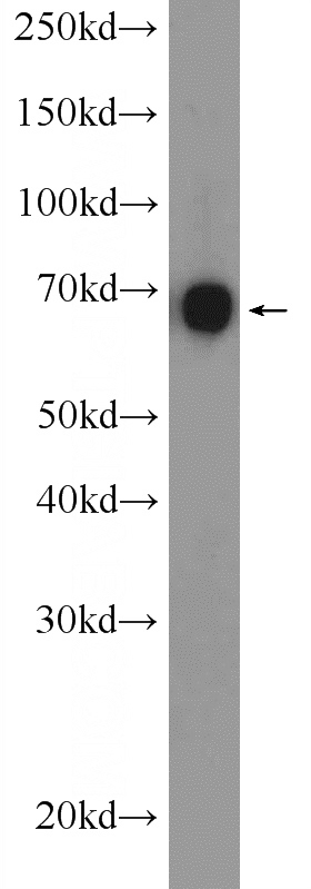 A549 cells were subjected to SDS PAGE followed by western blot with Catalog No:108085(ANKS1B Antibody) at dilution of 1:1000