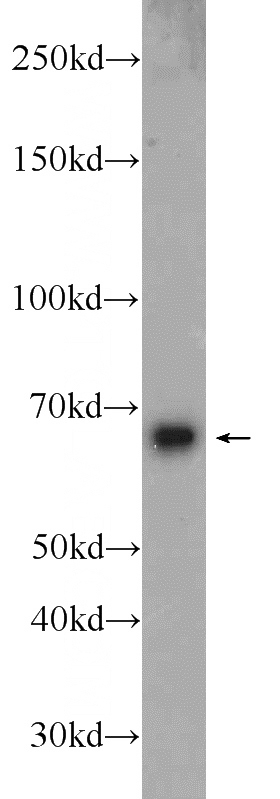 Jurkat cells were subjected to SDS PAGE followed by western blot with Catalog No:108392(B4GALNT2 Antibody) at dilution of 1:1000