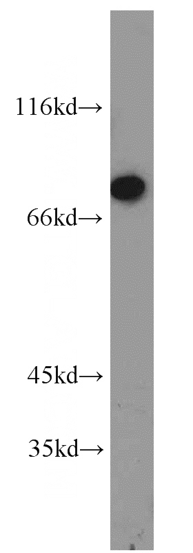 human skeletal muscle tissue were subjected to SDS PAGE followed by western blot with Catalog No:110889(GBE1 antibody) at dilution of 1:2000