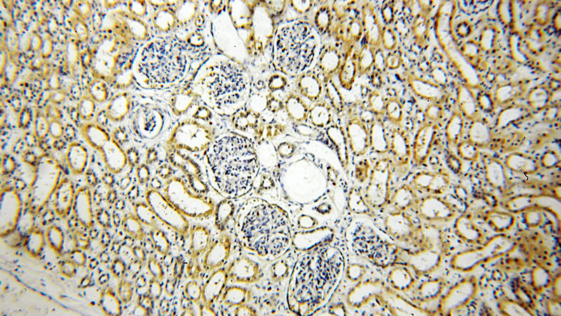 Immunohistochemical of paraffin-embedded human kidney using Catalog No:112101(KLHL29 antibody) at dilution of 1:100 (under 10x lens)