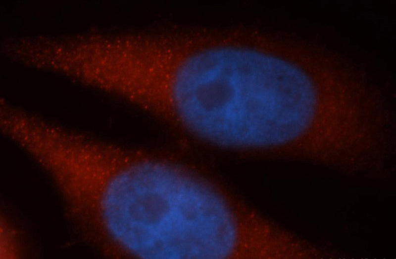 Immunofluorescent analysis of MCF-7 cells, using DYNC1H1 antibody Catalog No:110134 at 1:50 dilution and Rhodamine-labeled goat anti-rabbit IgG (red). Blue pseudocolor = DAPI (fluorescent DNA dye).