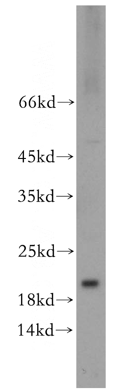 mouse brain tissue were subjected to SDS PAGE followed by western blot with Catalog No:110268(EIF5A2 antibody) at dilution of 1:500