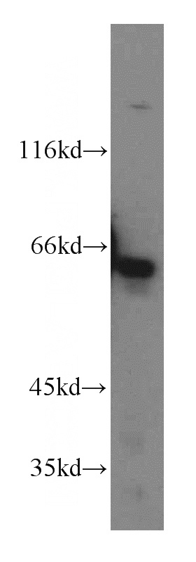 HepG2 cells were subjected to SDS PAGE followed by western blot with Catalog No:112095(KLHL18 antibody) at dilution of 1:600