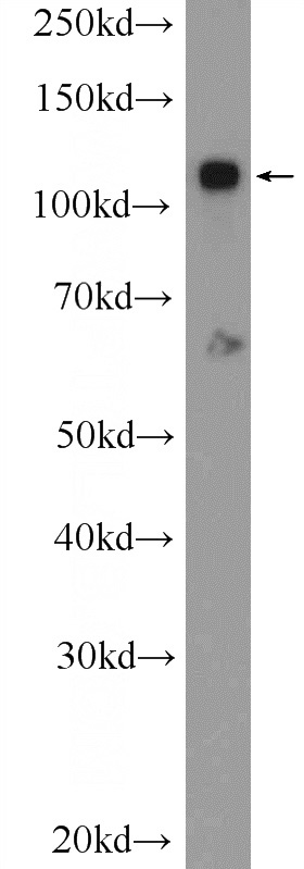 HUVEC cells were subjected to SDS PAGE followed by western blot with Catalog No:116927(ZC3H7B Antibody) at dilution of 1:600