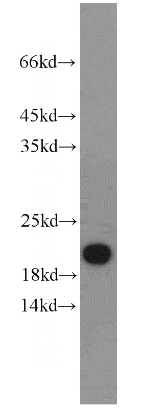 L02 cells were subjected to SDS PAGE followed by western blot with Catalog No:114166(PRAP1 antibody) at dilution of 1:1000