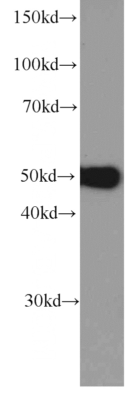 HeLa cells were subjected to SDS PAGE followed by western blot with Catalog No:107320(NAPRT1 Antibody) at dilution of 1:1500