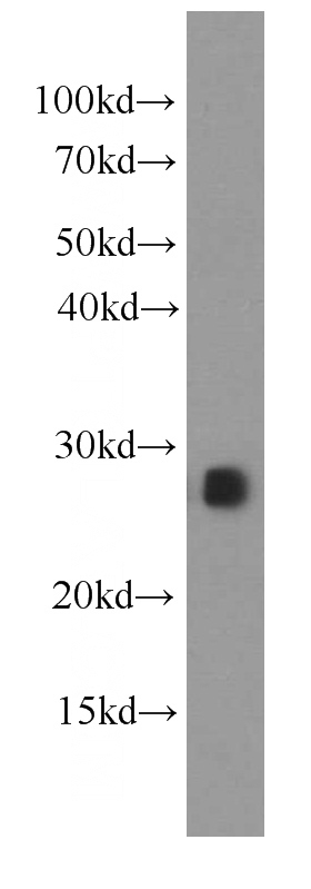 Recombinant protein were subjected to SDS PAGE followed by western blot with Catalog No:107384(IL17D antibody) at dilution of 1:20000