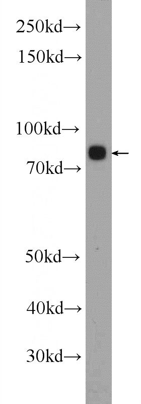 HL-60 cells were subjected to SDS PAGE followed by western blot with Catalog No:107662(ALOX5 Antibody) at dilution of 1:600