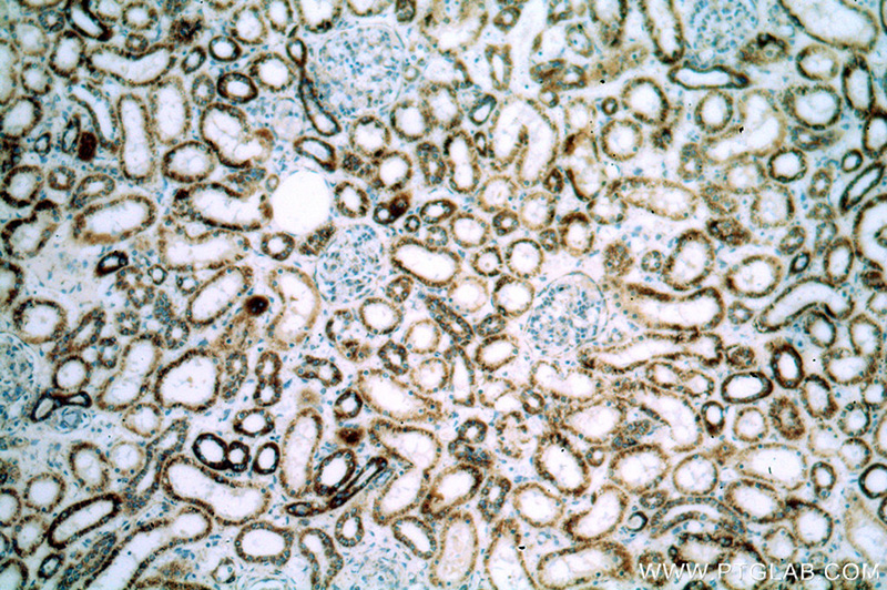 Immunohistochemical of paraffin-embedded human kidney using Catalog No:111332(HADH antibody) at dilution of 1:400 (under 10x lens)