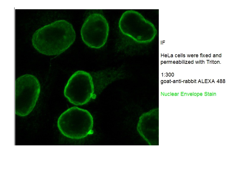 IF result of anti-EMD(Catalog No:110237) in Hela cell by Dr. Ralph Kehlenbach.