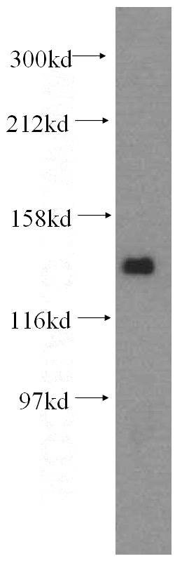 HeLa cells were subjected to SDS PAGE followed by western blot with Catalog No:113637(PDS5A antibody) at dilution of 1:400