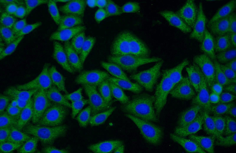 Immunofluorescent analysis of HepG2 cells using Catalog No:110994(GNB1 Antibody) at dilution of 1:50 and Alexa Fluor 488-congugated AffiniPure Goat Anti-Rabbit IgG(H+L)