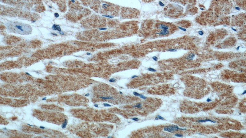 Immunohistochemical of paraffin-embedded human heart using Catalog No:114111(PPP3CB antibody) at dilution of 1:50 (under 40x lens)