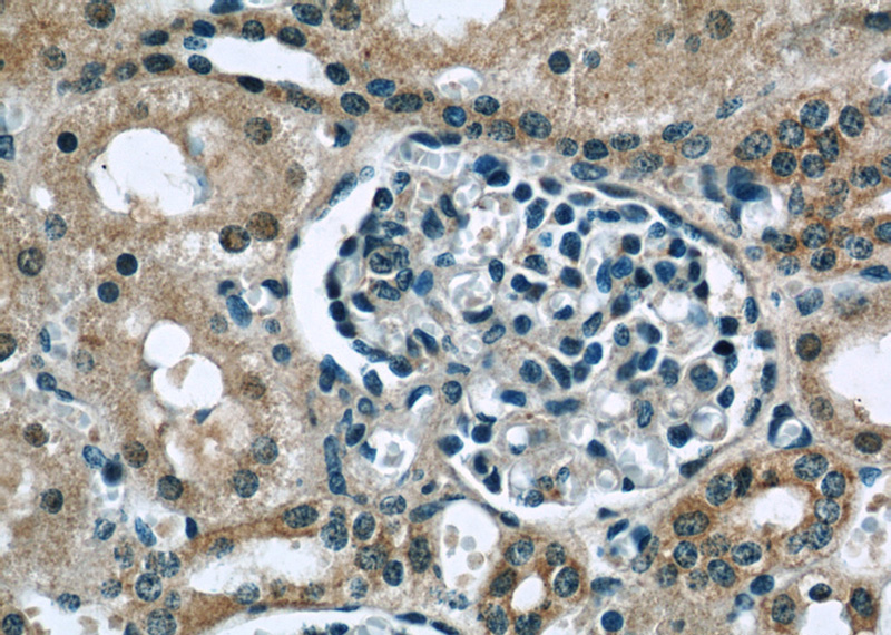 Immunohistochemistry of paraffin-embedded human kidney slide using Catalog No:111105(GNA14 Antibody) at dilution of 1:50