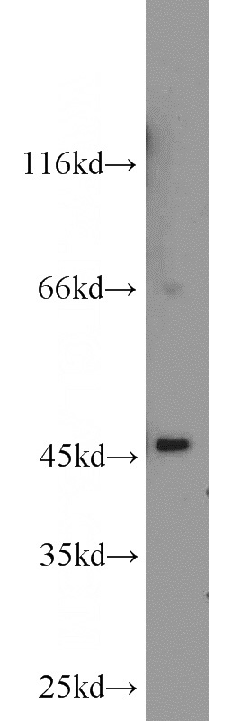 rat kidney tissue were subjected to SDS PAGE followed by western blot with Catalog No:107791(ADHFE1 antibody) at dilution of 1:1000