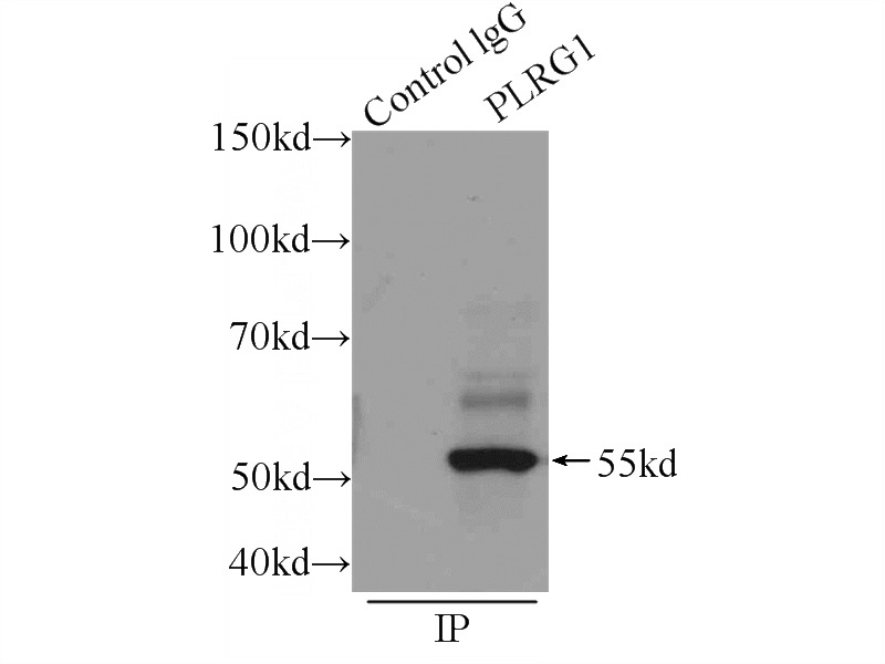 IP Result of anti-PLRG1 (IP:Catalog No:114008, 4ug; Detection:Catalog No:114008 1:1000) with HEK-293 cells lysate 1400ug.