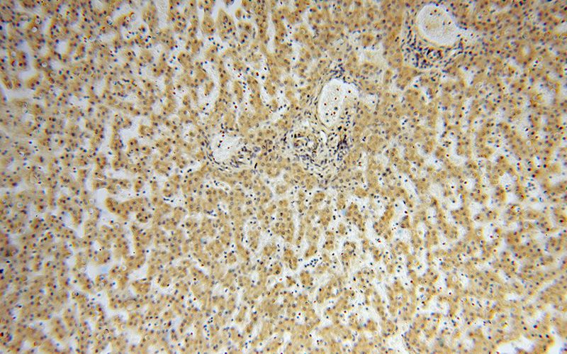 Immunohistochemical of paraffin-embedded human liver using Catalog No:116371(TSR2 antibody) at dilution of 1:50 (under 10x lens)