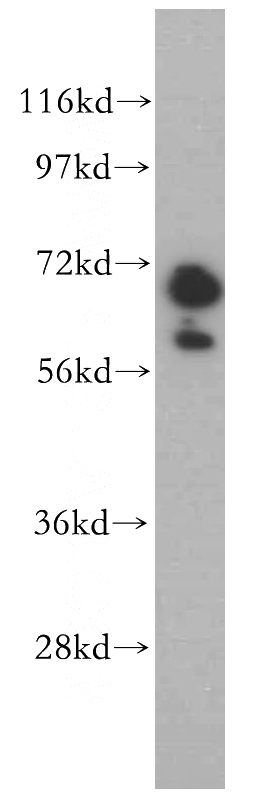 mouse brain tissue were subjected to SDS PAGE followed by western blot with Catalog No:110861(GAN antibody) at dilution of 1:500