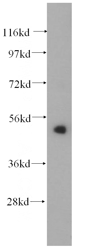 PC-3 cells were subjected to SDS PAGE followed by western blot with Catalog No:109422(CNDP2 antibody) at dilution of 1:200