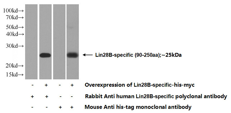 Transfected HEK-293 cells were subjected to SDS PAGE followed by western blot with Catalog No:112234(Lin28B-specific Antibody) at dilution of 1:1000