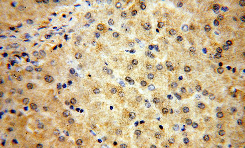 Immunohistochemical of paraffin-embedded human liver using Catalog No:112788(MTMR6 antibody) at dilution of 1:100 (under 40x lens)
