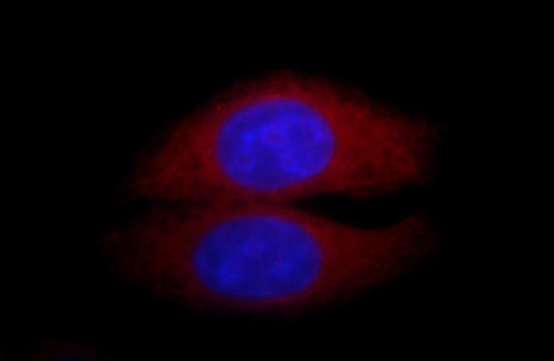 Immunofluorescent analysis of HepG2 cells, using CAPN2 antibody Catalog No:108835 at 1:25 dilution and Rhodamine-labeled goat anti-rabbit IgG (red). Blue pseudocolor = DAPI (fluorescent DNA dye).