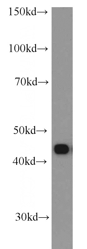 A549 cells were subjected to SDS PAGE followed by western blot with Catalog No:114933(RSAD2 antibody) at dilution of 1:500