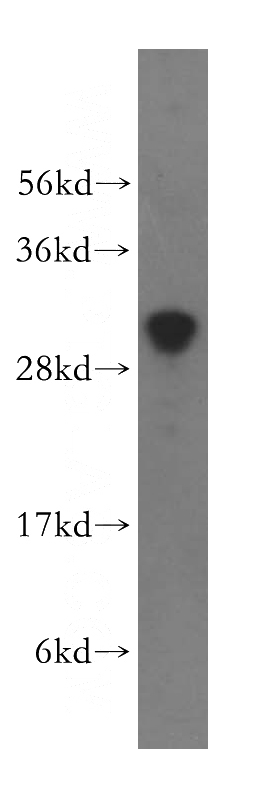 HEK-293 cells were subjected to SDS PAGE followed by western blot with Catalog No:116116(THYN1 antibody) at dilution of 1:500