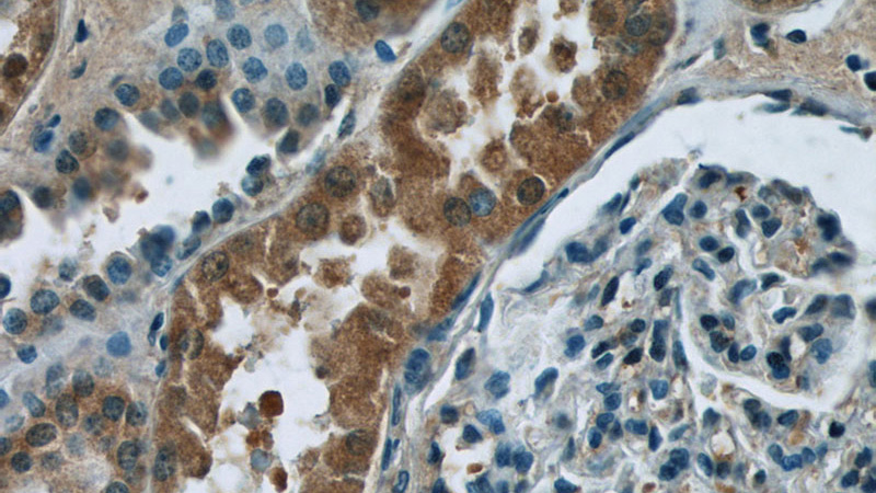 Immunohistochemistry of paraffin-embedded human kidney tissue slide using Catalog No:109219(CHD3 Antibody) at dilution of 1:50 (under 40x lens)