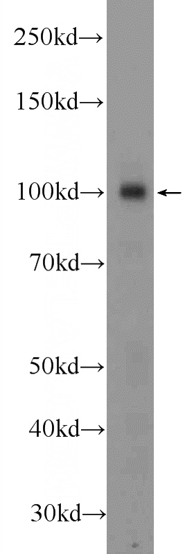 HEK-293 cells were subjected to SDS PAGE followed by western blot with Catalog No:116929(ZC3HAV1 Antibody) at dilution of 1:4000