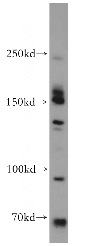 PC-3 cells were subjected to SDS PAGE followed by western blot with Catalog No:109040(CD109 antibody) at dilution of 1:500