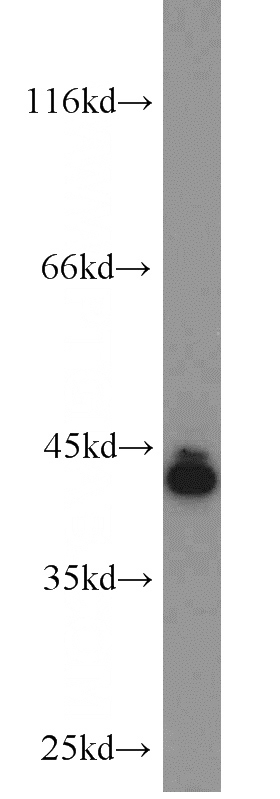 mouse liver tissue were subjected to SDS PAGE followed by western blot with Catalog No:114985(SCARA5 antibody) at dilution of 1:300