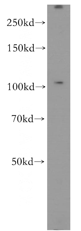 A549 cells were subjected to SDS PAGE followed by western blot with Catalog No:113694(PCDHA3 antibody) at dilution of 1:300